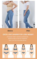 Fajas Shapewear High Compression Bodysuit Girdles with Brooches Bust for Daily and Post-Surgical Use Slimming Sheath Belly Women